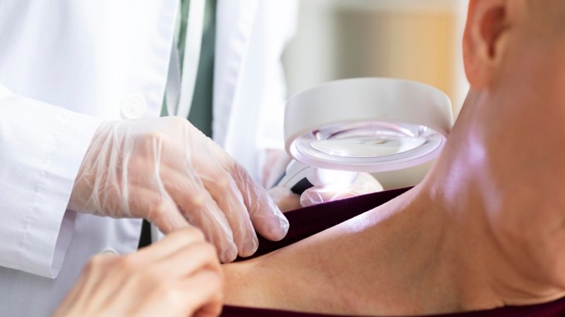 skin cancer clinic Brisbane